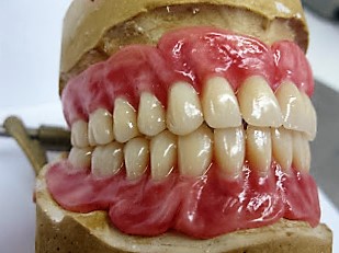 españa laboratorio dental en rosalejo – ignacio sanchez